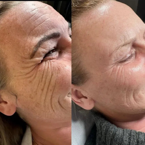 Poderosa crema anti-edad - Formula que transformara tu piel