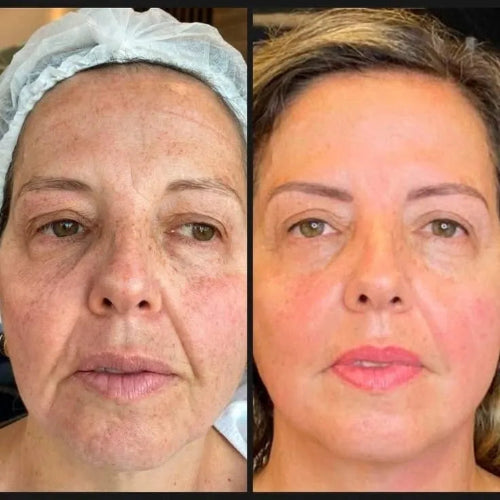 Poderosa crema anti-edad - Formula que transformara tu piel