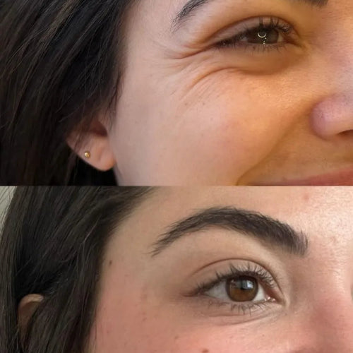 Poderosa crema anti-edad - Formula que transformara tu piel