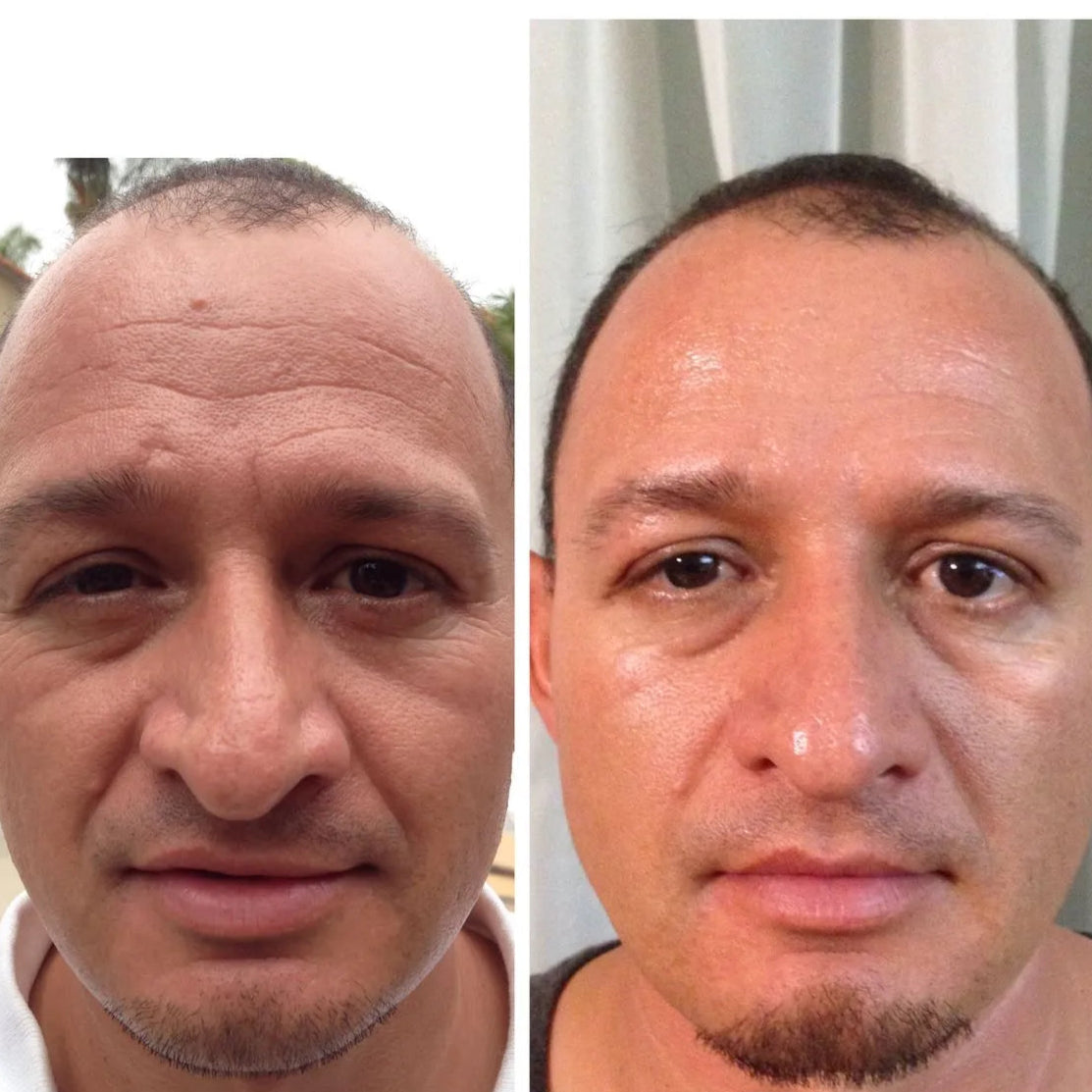 Ácido Hialurónico 24H Hombre