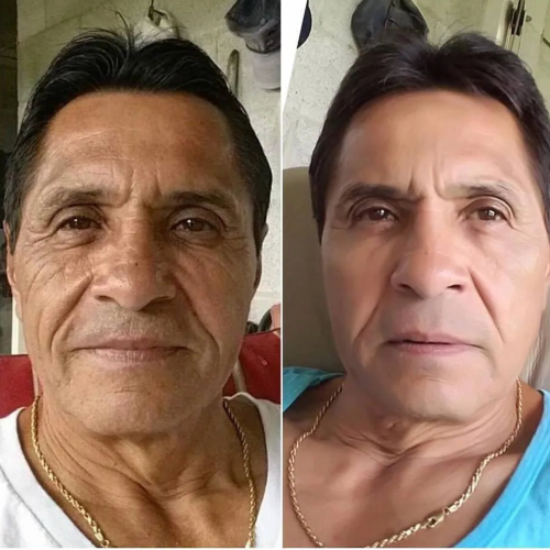 Ácido Hialurónico 24H Hombre