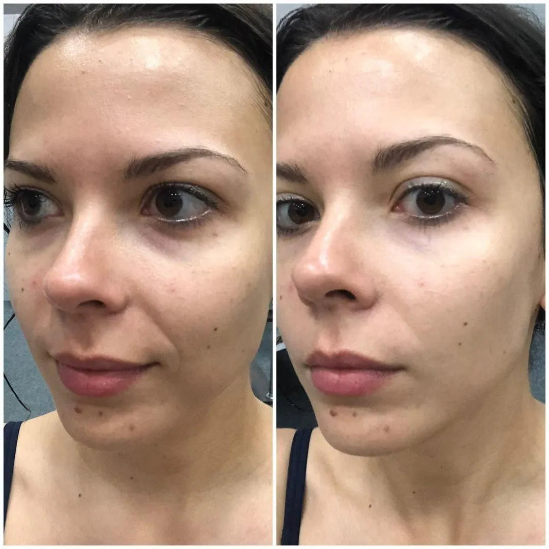 CREMA MERCILEN + CONTORNO MERCILEN