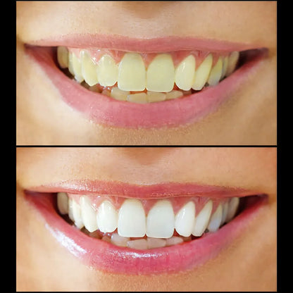 Polvo Limpiador Dental Morado 1ud Para P