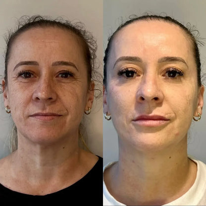 Maxiplux — Renueva, aclara y rejuvenece tu piel