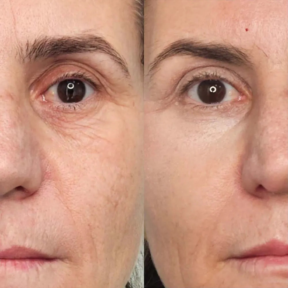 SERUM RESVERATROL + EXFOLIANTE LABIAL