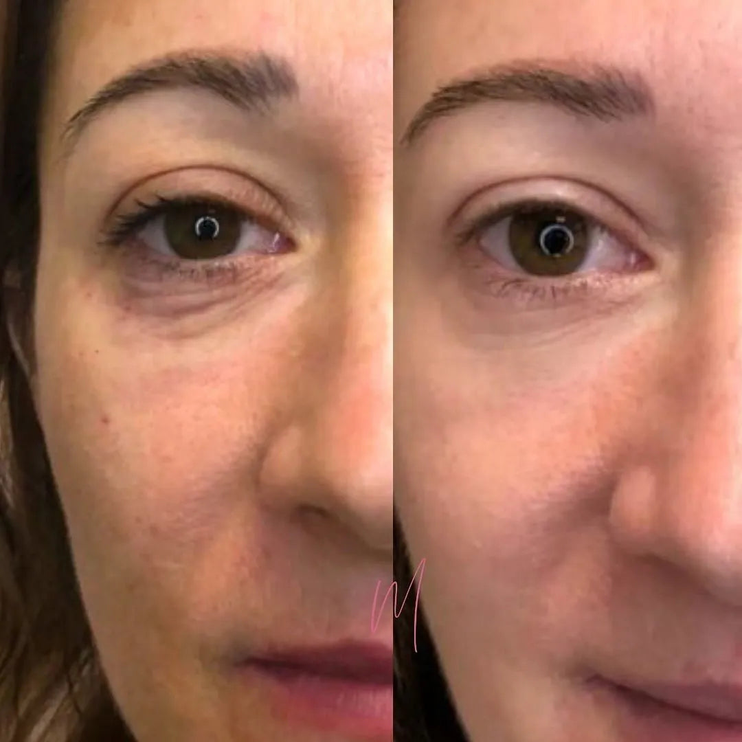 CREMA  MERCILEN + CONTORNO MERCILEN