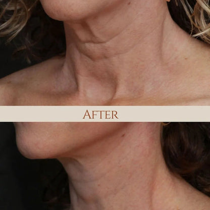 Maxiplux — Renueva, aclara y rejuvenece tu piel