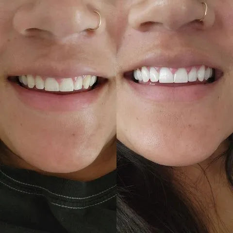 Polvo Limpiador Dental Morado 1ud Para P