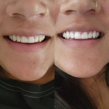 Polvo Limpiador Dental Morado 1ud Para P
