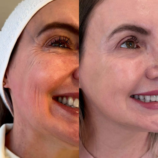 version 2 CREMA RESVERATROL + OBSEQUIO
