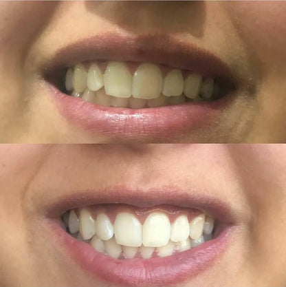 Polvo Limpiador Dental Morado 1ud Para P