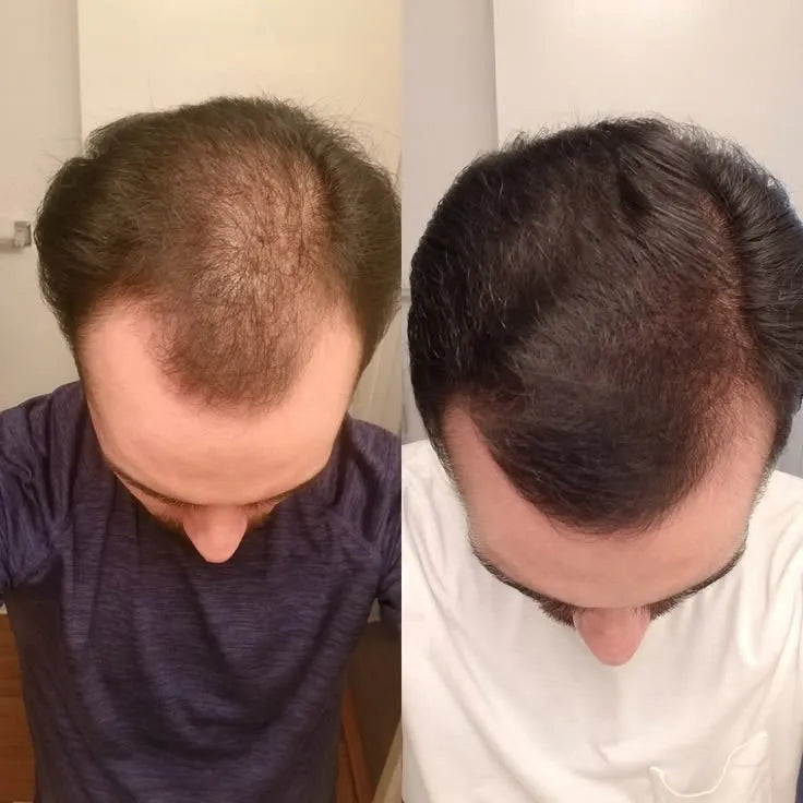 HAIR + BIGVITAL