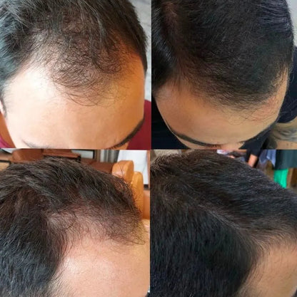 HAIR + BIGVITAL