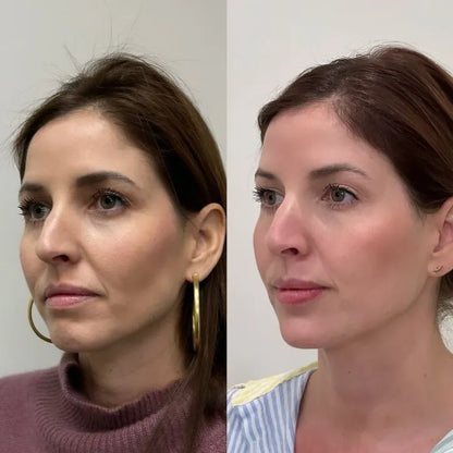 Bellezza Crema Facial anti edad