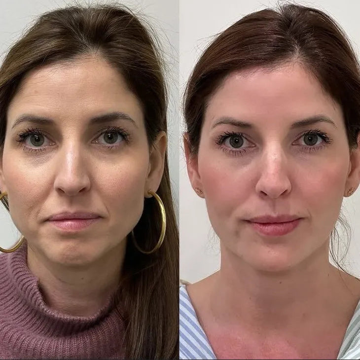 Bellezza Crema Facial anti edad
