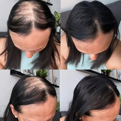 HAIR + BIGVITAL