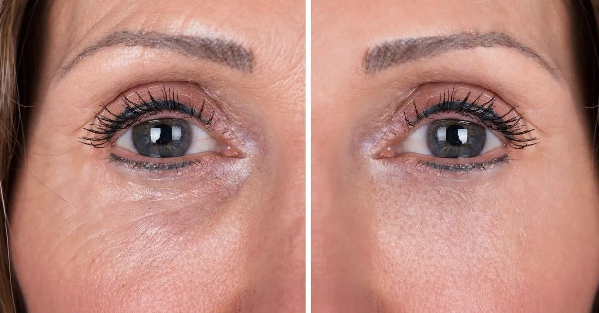 CREMA DE OJOS ANTI ARRUGAS MERCILEN