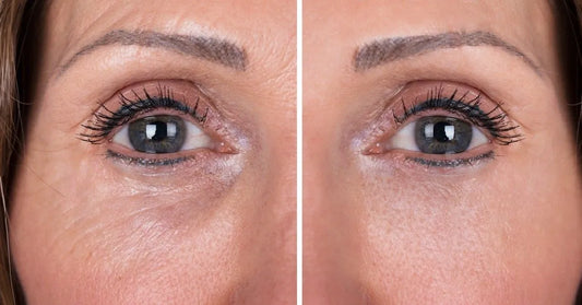CREMA DE OJOS ANTI ARRUGAS MERCILEN