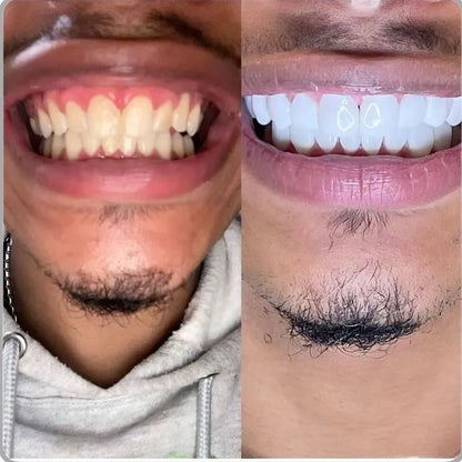 Polvo Limpiador Dental Morado 1ud Para P