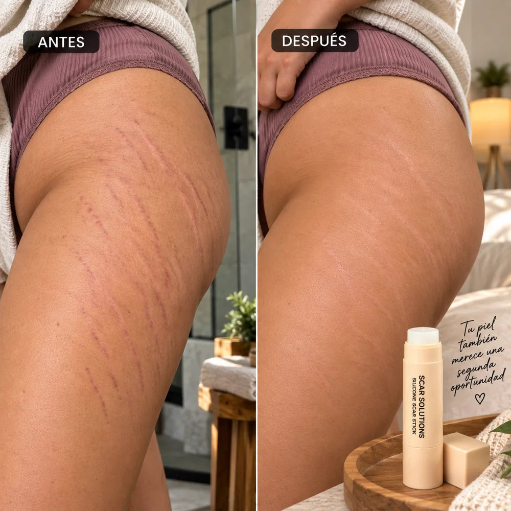 Comparación visual antes y después de cicatrices en muslo