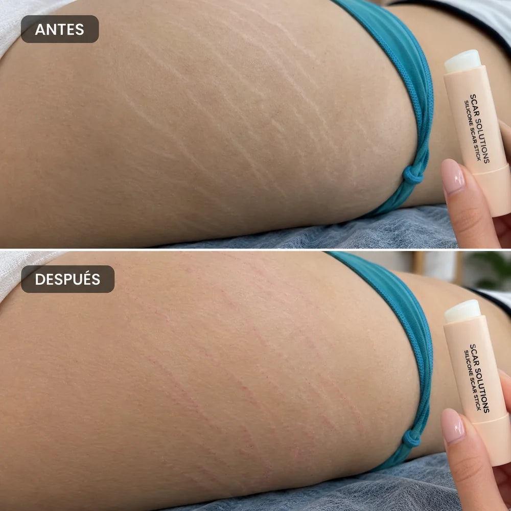 Comparación horizontal antes y después en muslo