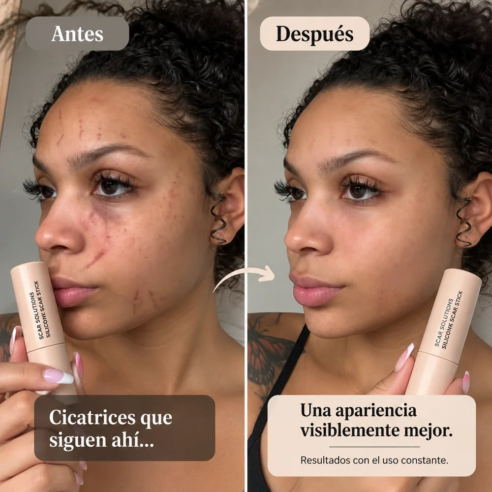Comparación visual antes y después de marcas en el rostro